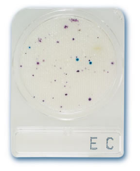 ecoli