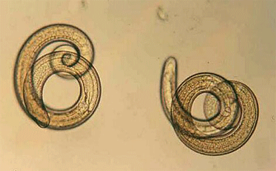 Trichinella spiralis (trikin,) larver